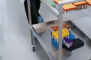 Diagnóstico de laboratorio